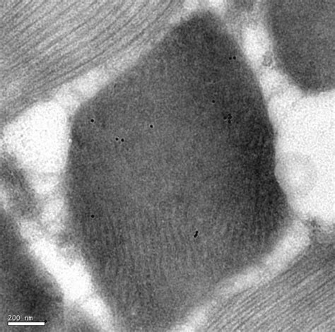 Immunoelectron Micrograph Showing Immunogold Labelling On A Section Of