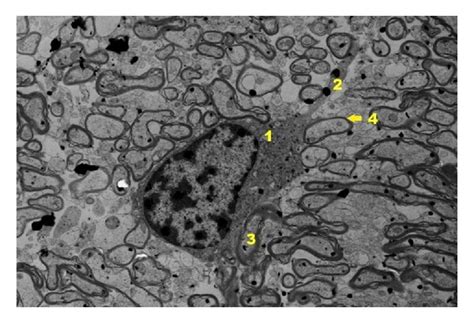 Ultrastructural image of neurofibrils of hippocampus in group C ... 