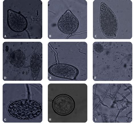 Micro Morphological Features Of Phytophthora Nicotianae Isolates A And