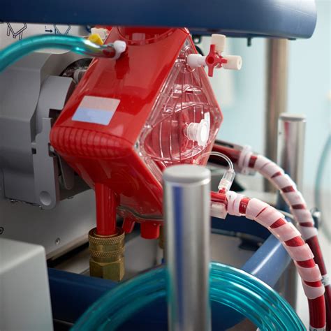 Ecmo Extracorporeal Membrane Oxygenation 4
