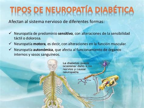 Neuropatía Diabética Periferica Y Visceral