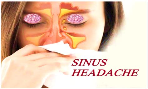 Don T Take Sinus Headaches Easily Detailed Guide Dr Meenesh Juvekar Ent Specialist