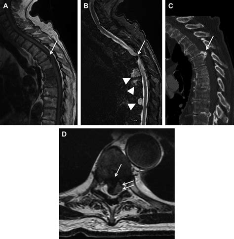 The Degenerative Spine Magnetic Resonance Imaging Clinics