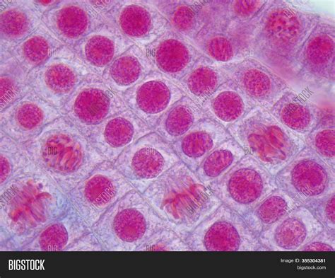 Prophase Metaphase Anaphase Telophase Microscope