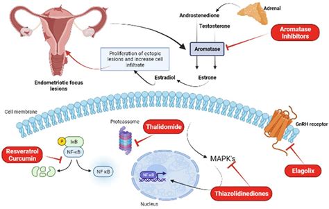 Treatment Of Endometriosis Encyclopedia Mdpi