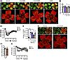 Jci Soluble Epoxide Hydrolase Promotes Astrocyte Survival In