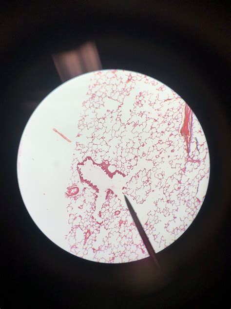 Alveoli Diagram Quizlet