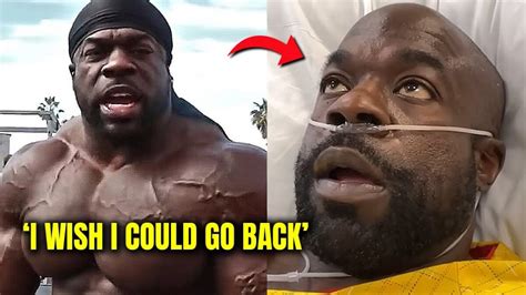 Kali Muscle Destroyed His Body From Steroids Ironmag Bodybuilding And Fitness Blog