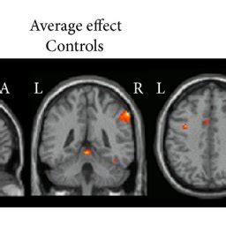 Brain Regions Showing Significant Activation Colour Coded With