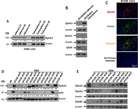 Immunoreactive Profile Of Epha In Gbm Tumorspheres And Snap Frozen