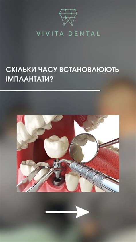 an image of dental equipment with the caption'what is your tooth?