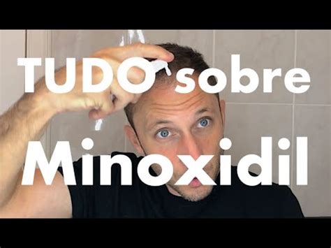 Como Usar Aplicar Minoxidil Pant Para Queda De Cabelo Barato E