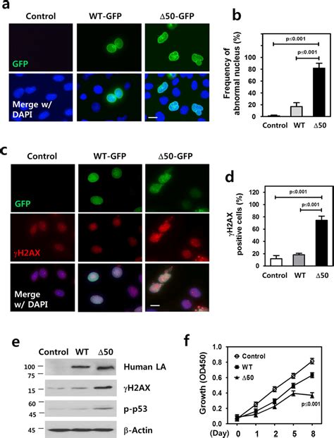 Induction Of Dna Damage And Cellular Senescence By Progerin Expression