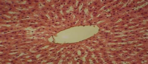 Cross Section In Liver Of Male Rabbit Treated With Vita 5000 Iu