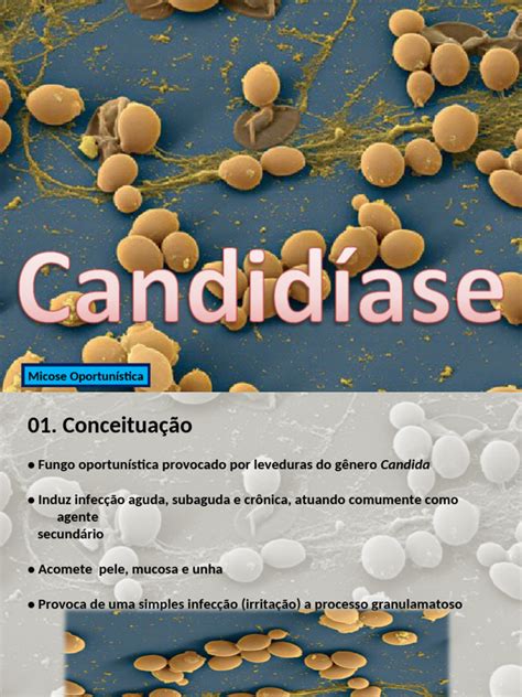 A Candidíase É Uma Infecção Causada Por - Candidíase: Infecções por Candida | PDF | Candidíase | Infecção