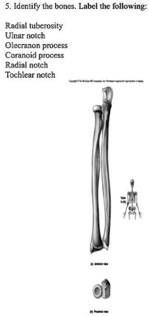 Solved Identify The Bones Label The Following Radial Tuberosity