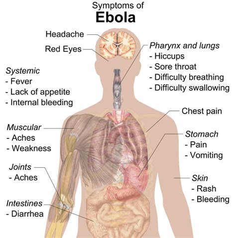 Ebola Virus Disease Pictures New Health Advisor