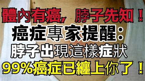 癌症專家提醒：人體內有癌，脖子先知！脖子出現這樣症狀，99癌症已纏上你了！千萬不要忽略！ ！ ！ Youtube