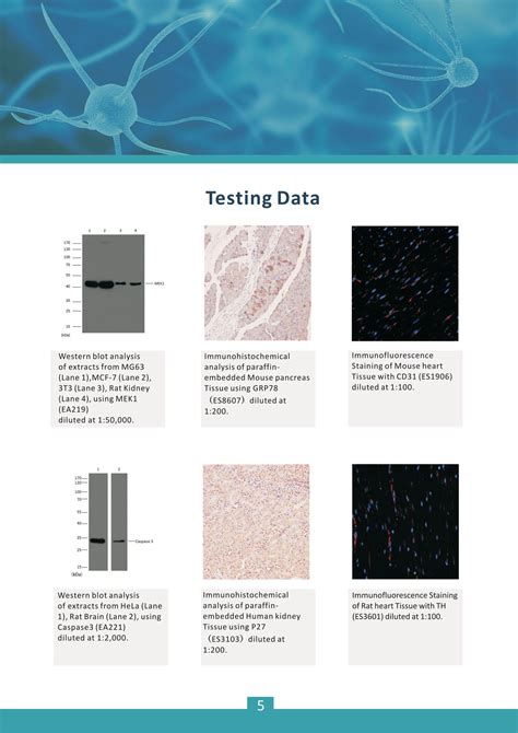 Elk Biotechnology 한국공식총판대리점 다양한 종류의 Antibody Elisa Kit Prep Kit들을