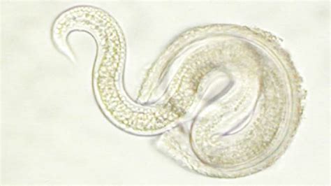 Parasitic Worms May Keep Inflammatory Bowel Disease at Bay | Mental Floss