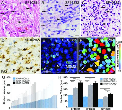 Association Of Proliferation Markers And Cell Size In Patient Derived