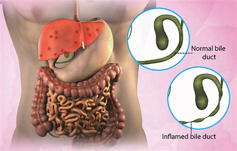 Health Condition Symptoms Causes Treatment And More