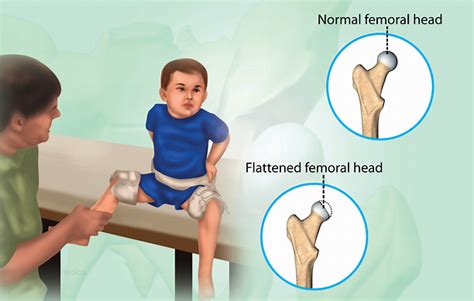 Health Condition : Symptoms, Causes, Treatment and More