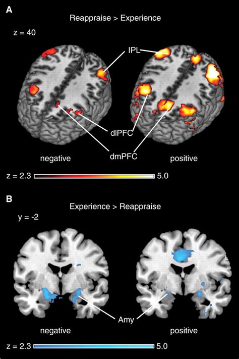 Neural Correlates Of Cognitive Reappraisal And Emotional Experience