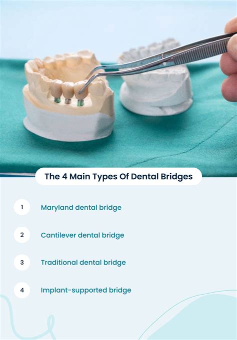 How Much Does A Dental Bridge Cost A Price Breakdown With And Without