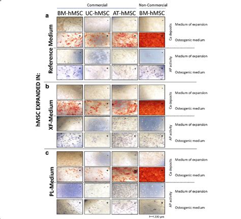 Osteogenic Differentiation Of Human Mesenchymal Stem Cells