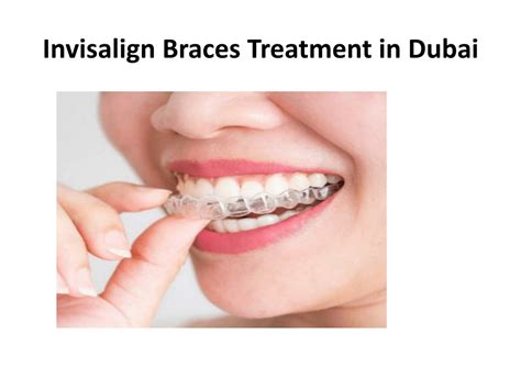 Ppt Invisalign Braces Treatment Powerpoint Presentation Free