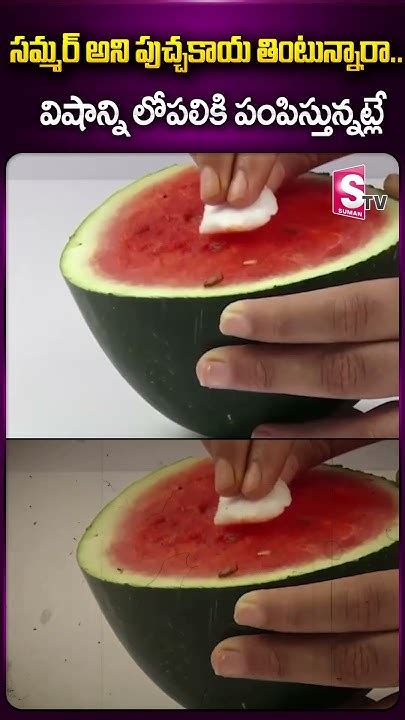 సమ్మర్‌ అని పుచ్చకాయ తింటున్నారా Latestnews Viralpost Summer Watermelon Ytshorts Sumantv