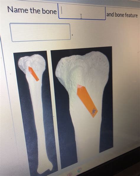 solved   bone  bone feature cheggcom