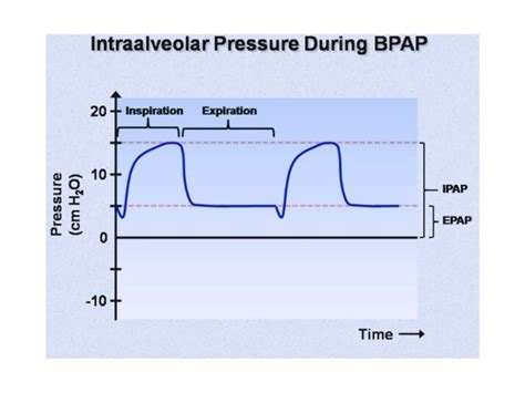 CPAP vs BiPAP? | Student Doctor Network