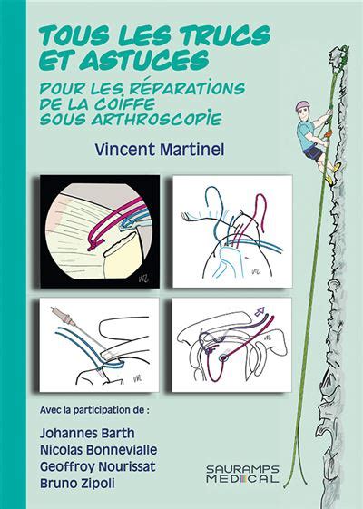 Tous Les Trucs Et Astuces Pour Les Reparations De La Coiffe Sous