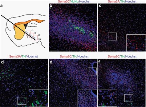 Transfected Hek293 Cells Secrete Sema3c Or Sema3a In Vivo A Diagram