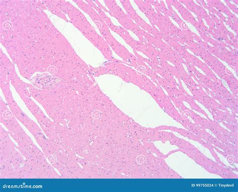 Histology Of Human Heart Muscle Tissue Stock Photo Image Of Tissue