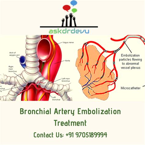 Bronchial And Pulmonary Artery