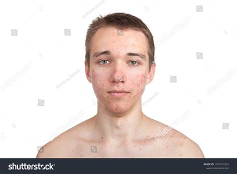 Before Puberty Naked Images Stock Photos Vectors Shutterstock