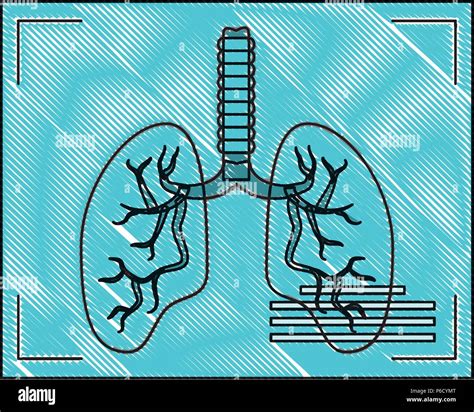 Lungs Xray Icon Over White Background Vector Illustration Stock Vector