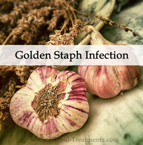 Herbal Medicine Program for Golden Staph Infection - Avnayt & Waltham's ...