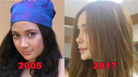 Arci Munoz Plastic Surgeries Through The Years Youtube