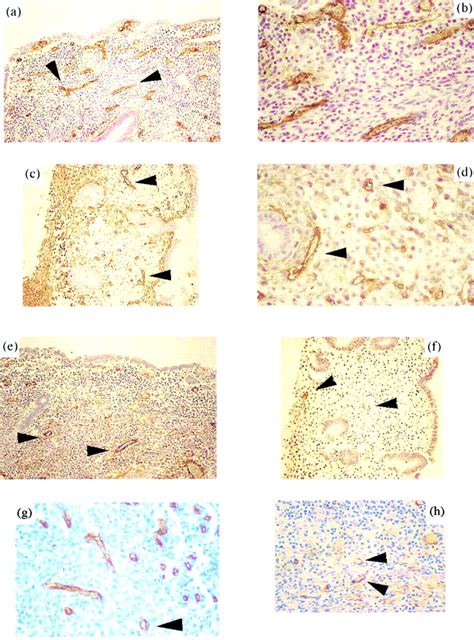 Immunohistochemistry For Cd And For Smooth Muscle Actin Sma