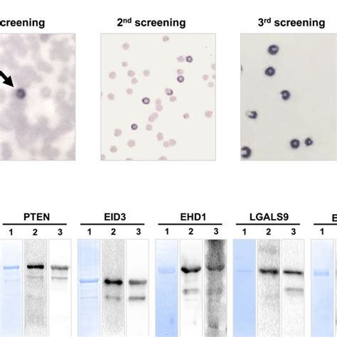 Serex Screening And Western Blot Analysis Of Recombinant Gst Fusion