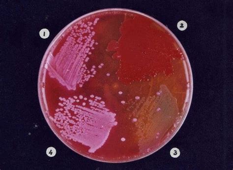 Types Of Organisms And Their Nature On Blood Agar Plate Escherichia