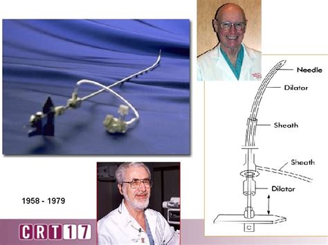 How To Perform A Successful Transseptal Puncture Zoltan