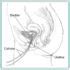 Urodynamics Testing Bladder Testing Preparation And Follow Up