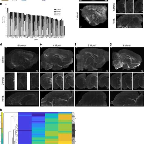 SWITCH labeling reveals Papez circuit vulnerability and network ... 