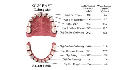 Gigi Pada Anak Klinik Dr Tiwi