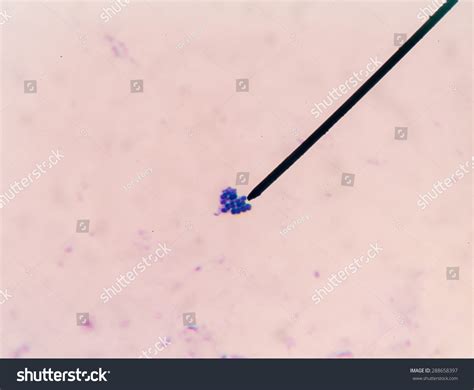 Gram Positive Cocci Find Microscope Stock Photo 288658397 | Shutterstock